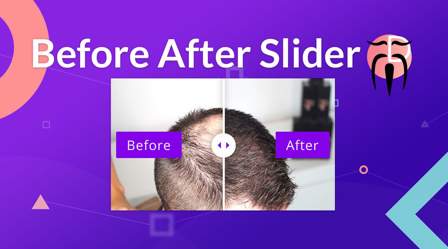 Imagen promocional de Before After Slider